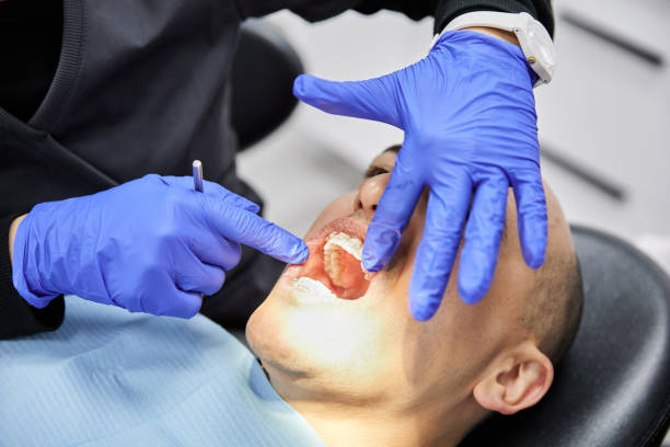 Best Emergency Wisdom Tooth Extraction in Sandersville, GA