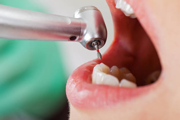 Best Emergency Treatment for Jaw Pain or Injury in Sandersville, GA